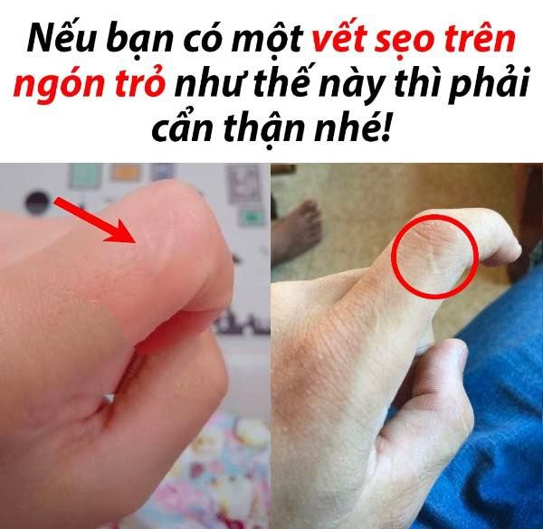 Cẩn thận nhé -  haivl | hài hước | hài vl  