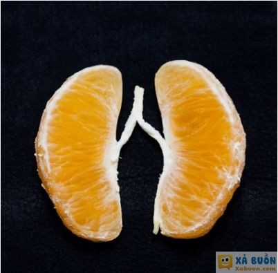  :3  em bảo giống lá phổi mà bạn gái quýnh em :((  :x :x 