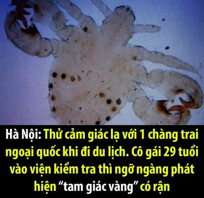 Gòi gòi -  haivl | hài hước | haiivl| bigo viet 