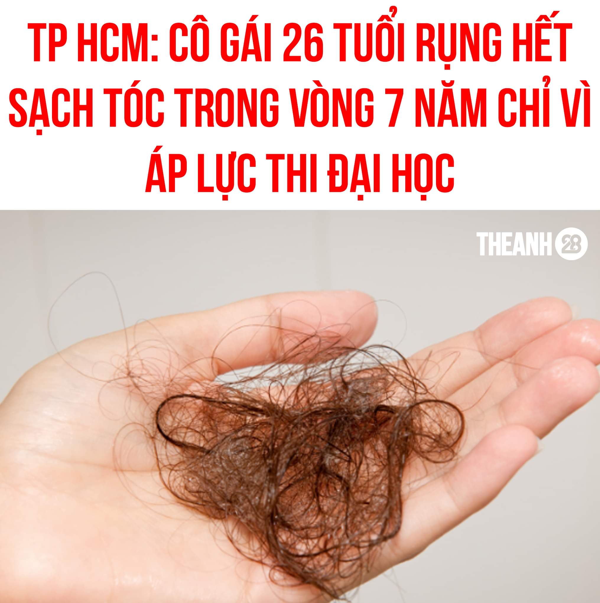 ÁP LỰC THI CỬ, CÔ GÁI RỤNG HẾT SẠCH TÓC

N.P.T (26 tuổi, quận Tân Bình, TP.HCM) chia sẻ cô từng có mái tóc xoăn tự nhiên, đen bóng và dày. Thời điểm học lớp 12, áp lực thi cử khiến T. bị rụng tóc từng mảng lớn.Xem thêm Khi vào đại học, cô luôn tự ti với mái tóc của mình nên thường xuyên thay đổi kiểu tóc, đội mũ, tóc giả. Suốt thời gian đó, tóc vẫn không ngừng rụng.

Gia đình đã đưa chị T. đi điều trị, tốn cả 100 triệu đồng nhưng không hiệu quả. Sau hơn 7 năm miệt mài đi khắp nơi lớn , nhỏ từ spa tới các bệnh viện lớn thì lần này được bác sĩ tư vấn điều trị bằng phương pháp lăn kim. Lần đầu tiên sau 7 năm, tóc của cô đã mọc trở lại.

Theo Thạc sĩ, bác sĩ Trương Thị Huyền Trang - Khoa Nghiên cứu và Ứng dụng Công nghệ Tế bào gốc - Bệnh viện Da liễu Trung ương cho biết, hằng ngày tóc sẽ rụng khoảng 50-100 sợi. Nếu tóc rụng quá số lượng này là bệnh lý. Khi đó, bạn cần tới các cơ sở y tế chuyên khoa để được hỗ trợ.

Theo: Vietnamnet